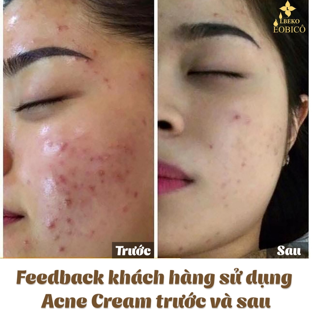 cảm nhận 5 