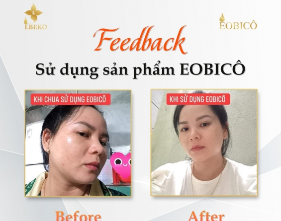 Thả nhẹ một chiếc feedback siêu xịn